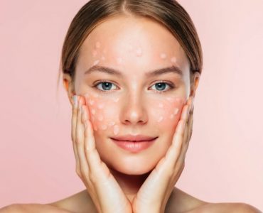 rosacea_symptoms_and_treatment