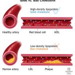 Exploring Cervical Spondylosis: Symptoms & Causes