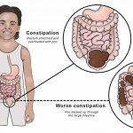 Coughing Up Answers: Understanding the Causes, Types, and Seriousness of Coughs