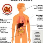 Catching a Chill: Understanding the Common Cold and How to Tackle It