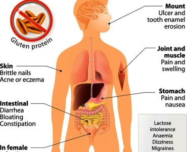 Celiac Disease