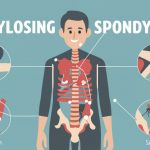 Angina: Symptoms, Causes, and Treatment Options