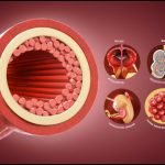 Breathe Easy: Understanding Asthma, Symptoms, and Management Strategies