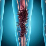 Navigating the Journey: A Comprehensive Guide to Crohn’s Disease and Ulcerative Colitis