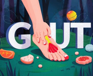 gout