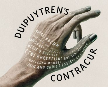 dupuytrens_contracture
